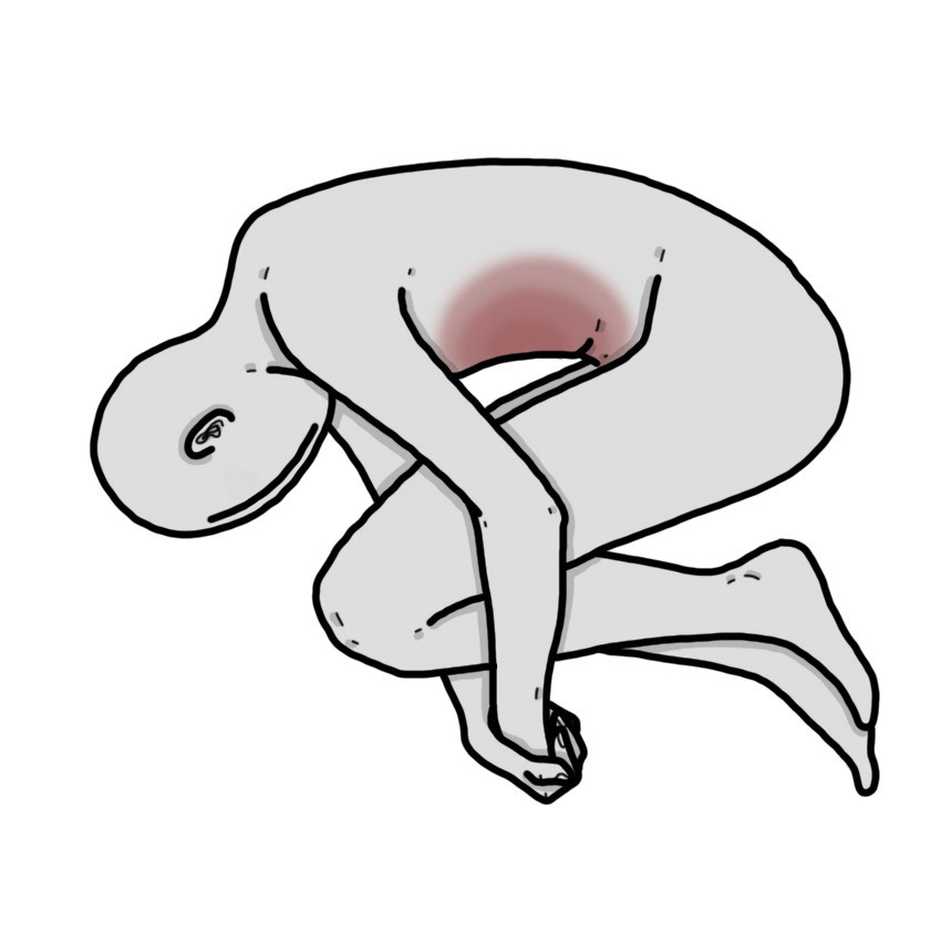 Signos de irritación peritoneal