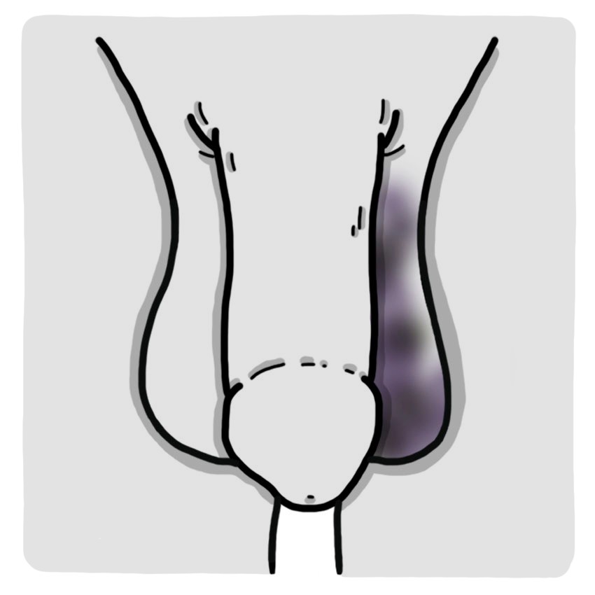Scrotum has become darker