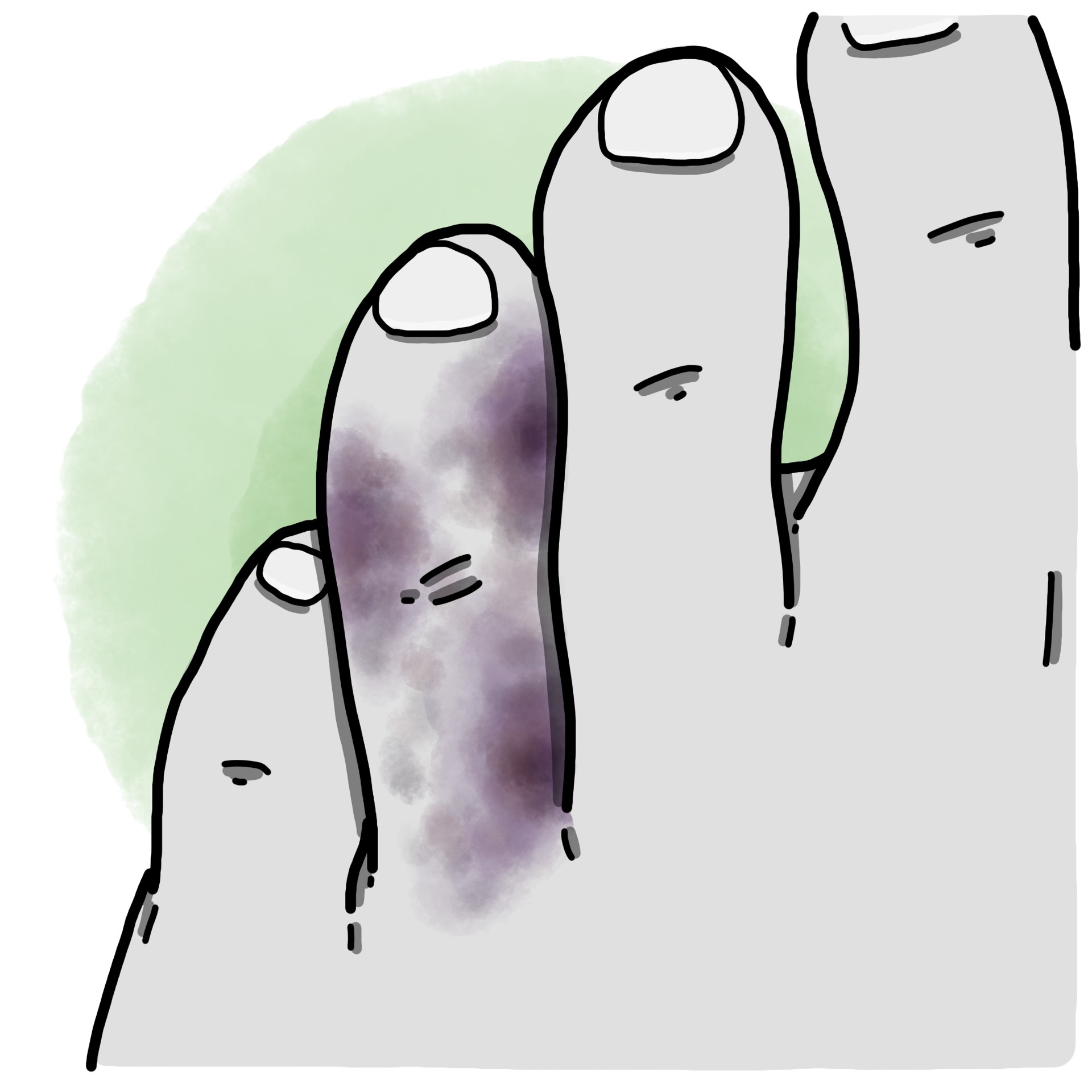 Toe trauma - Toe contusion