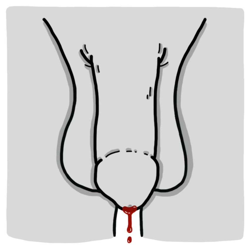 Urethrorrhagia