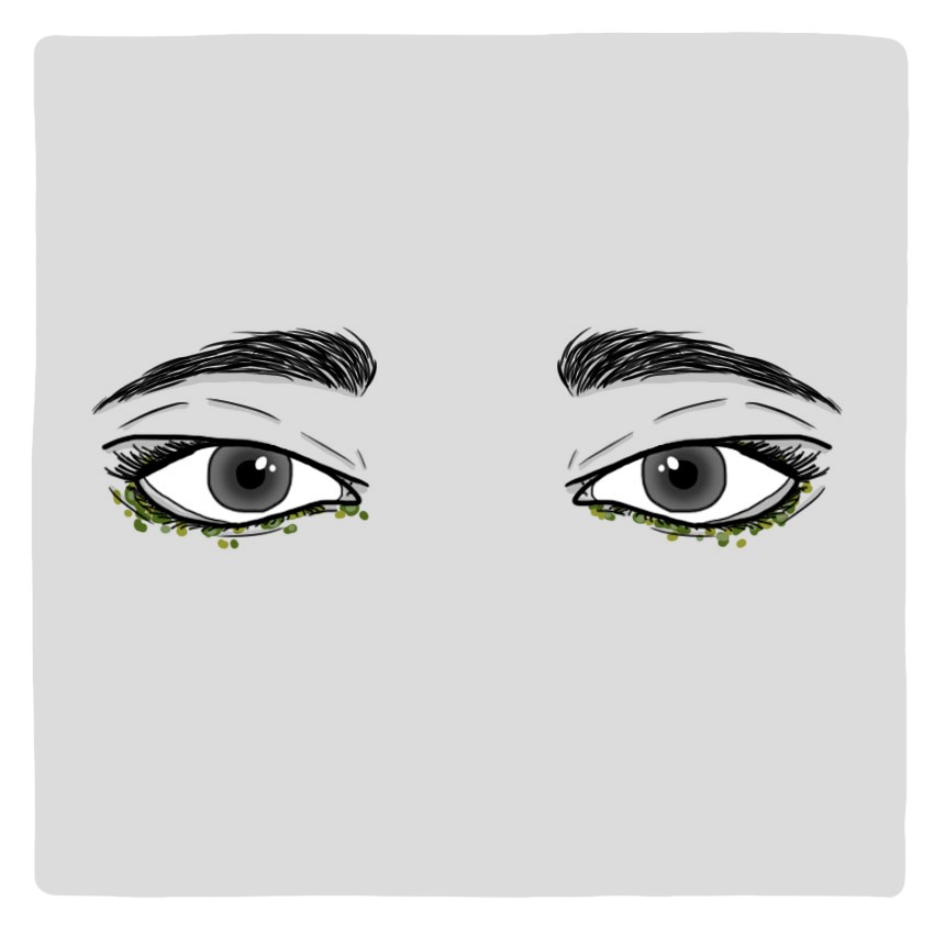 Greenish discharge coming from the eye