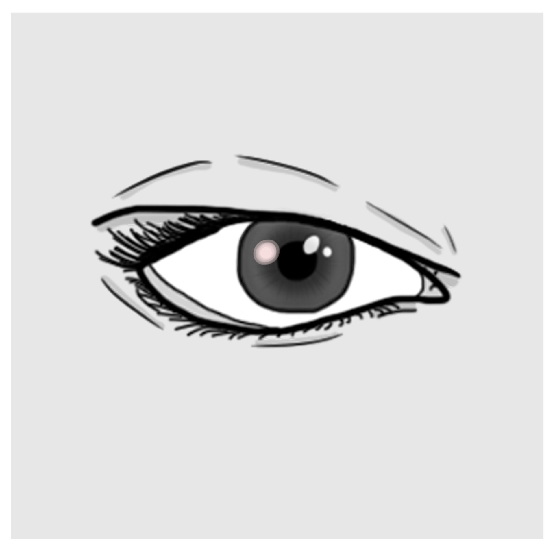 Corneal abrasion - Corneal foreign body