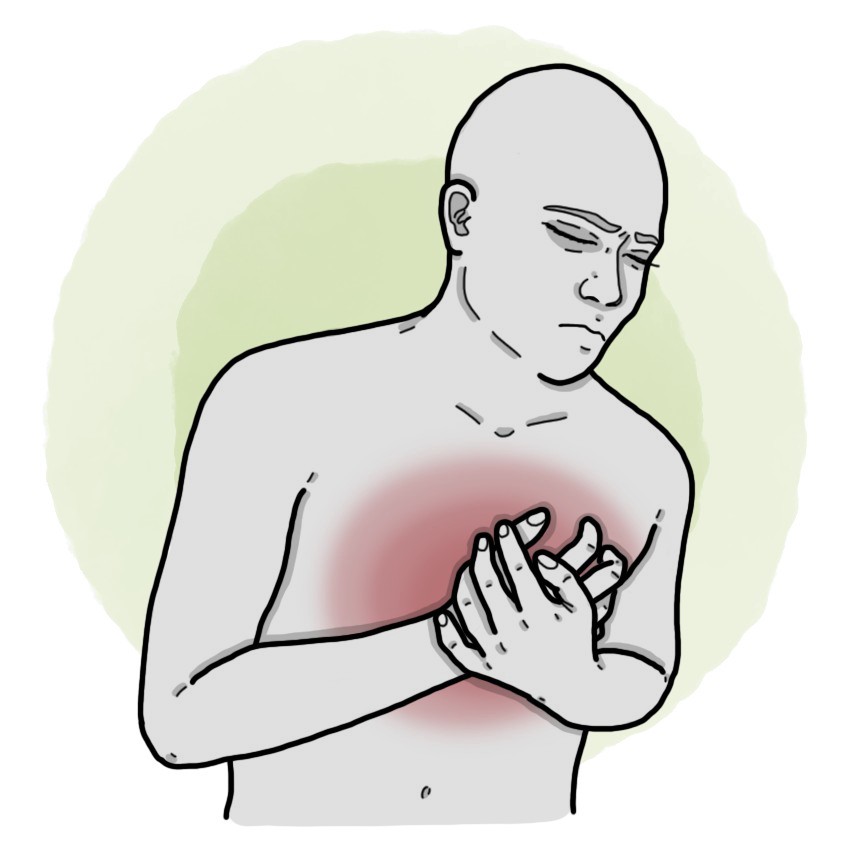 Musculoskeletal chest pain