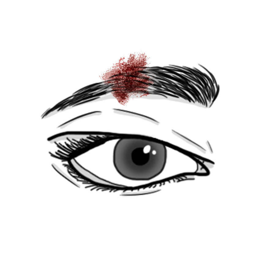Eyebrow burn