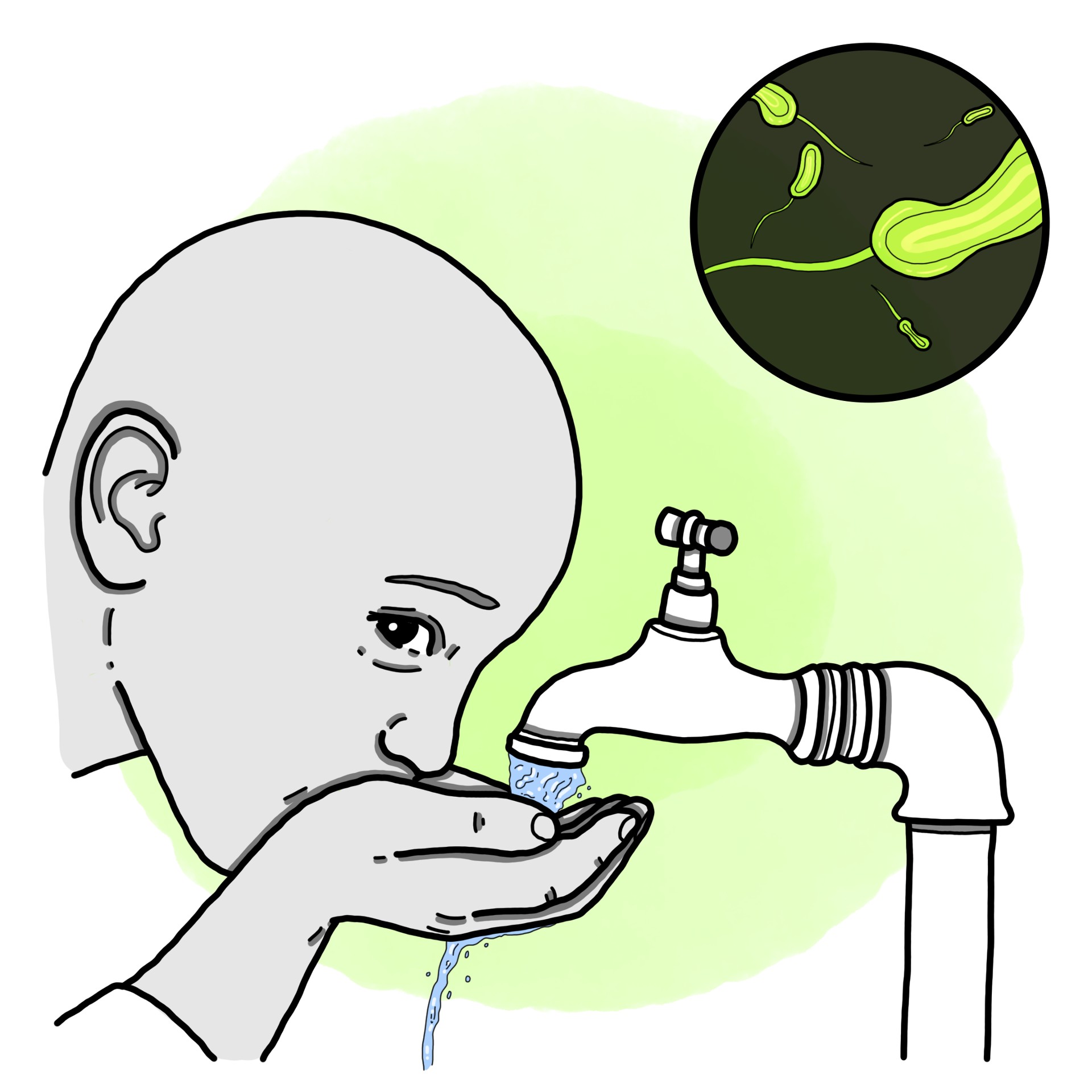 Cholera - Aqueous or choleriform diarrhoea