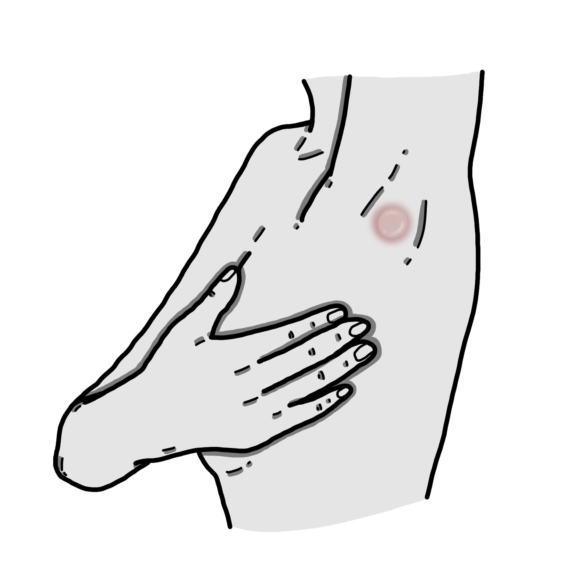 Geschwollene axilläre Lymphknoten