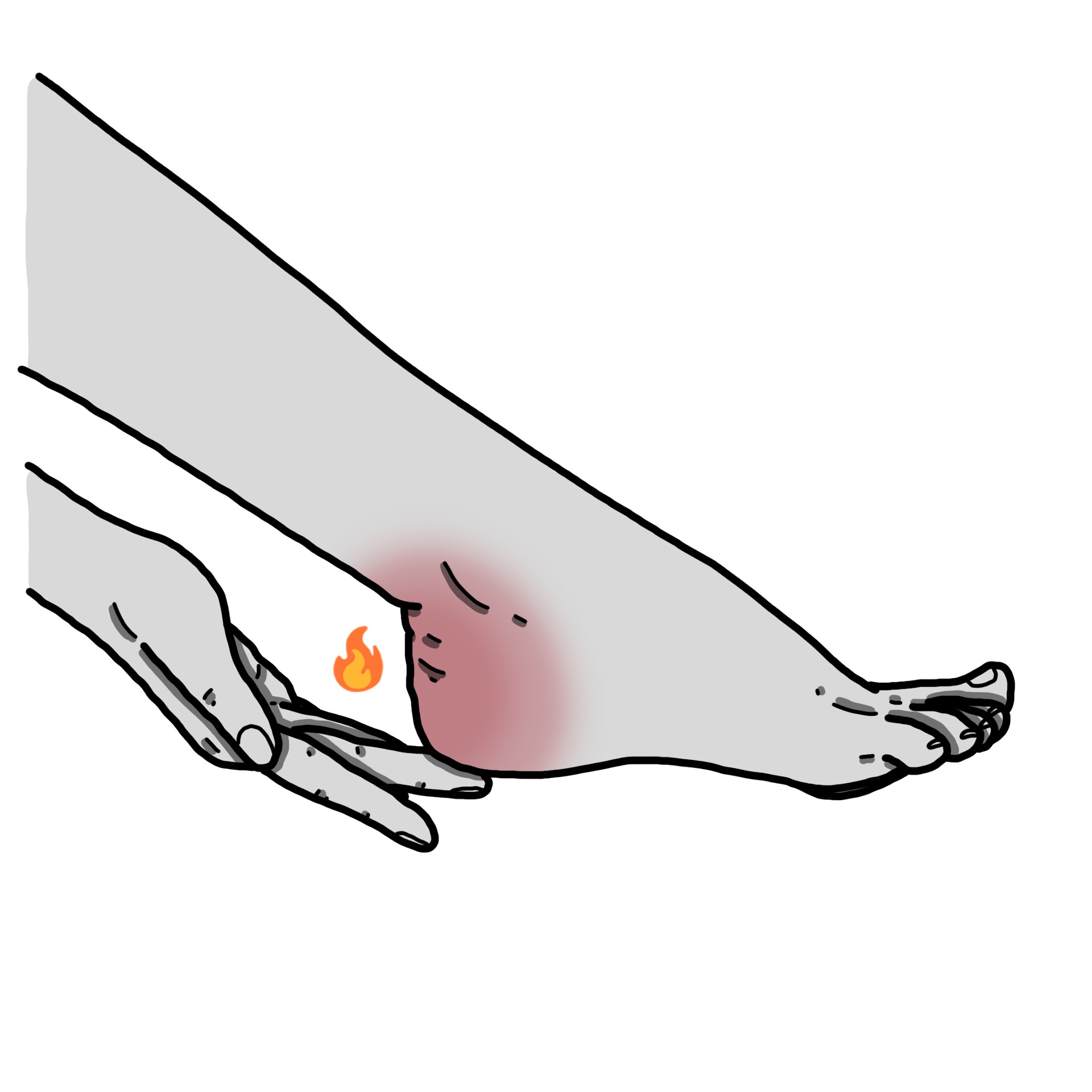 Sensazione di bruciore nella parte posteriore dei piedi