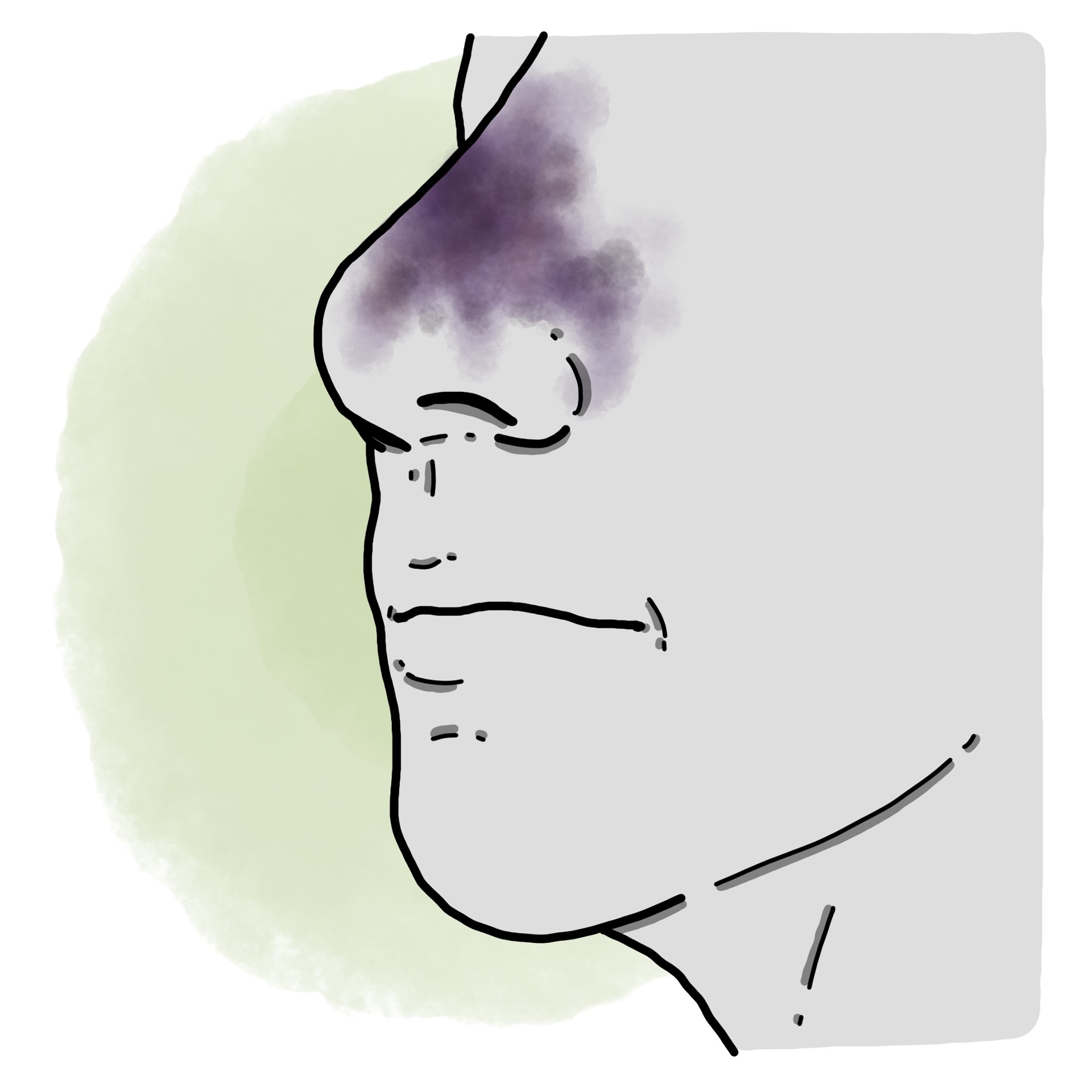 Nasal trauma