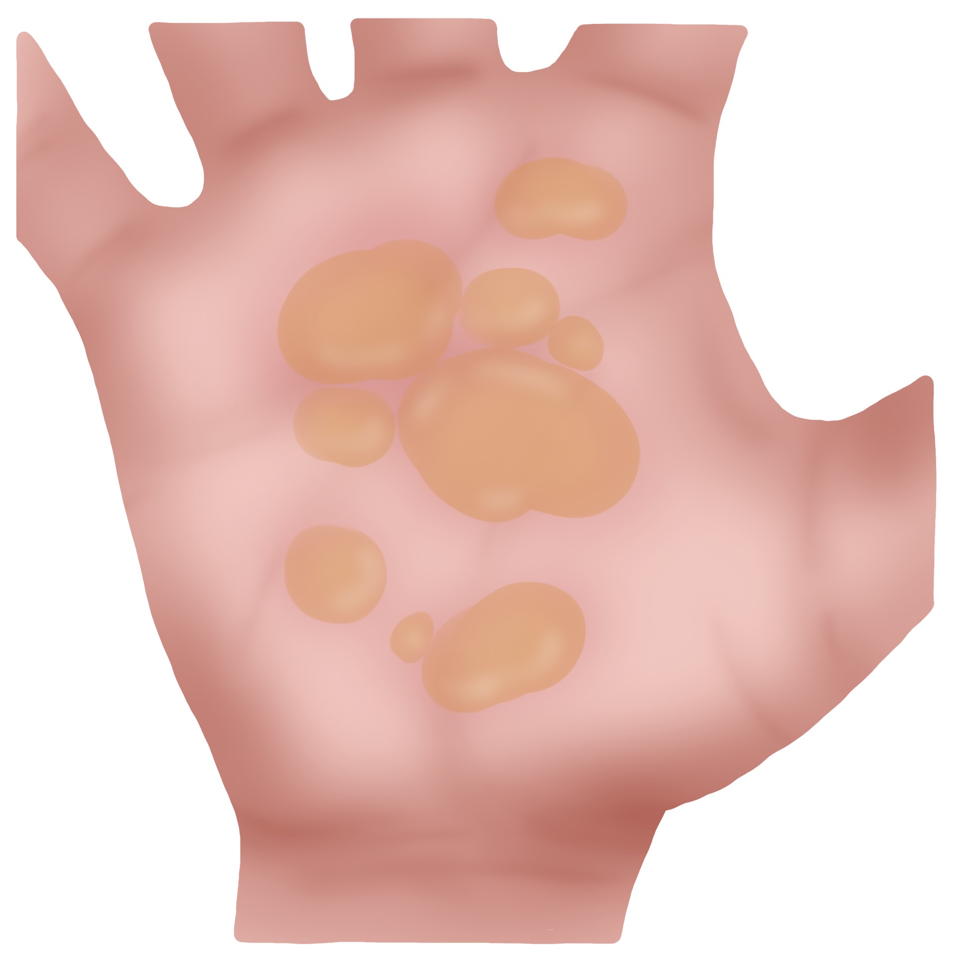 Vesicles join into a larger one