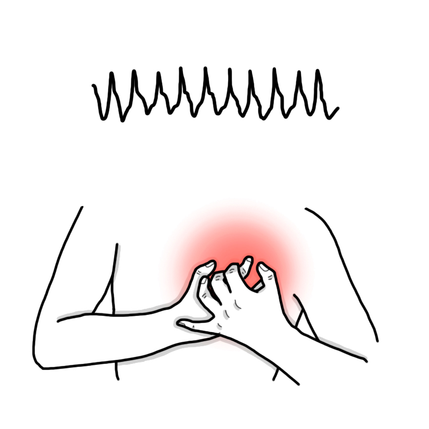 Ventricular tachycardia