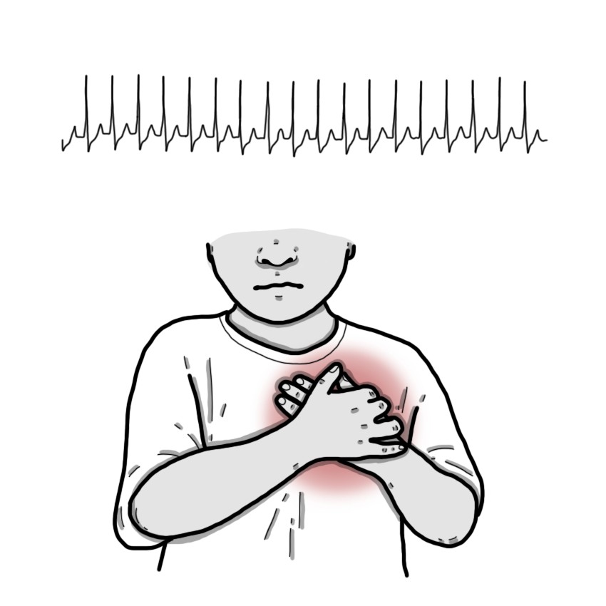 Supraventricular tachycardia (Paediatrics)