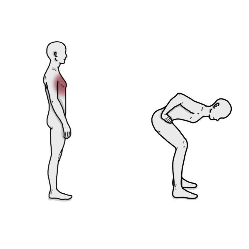 Chest pain decrease when leaning forward