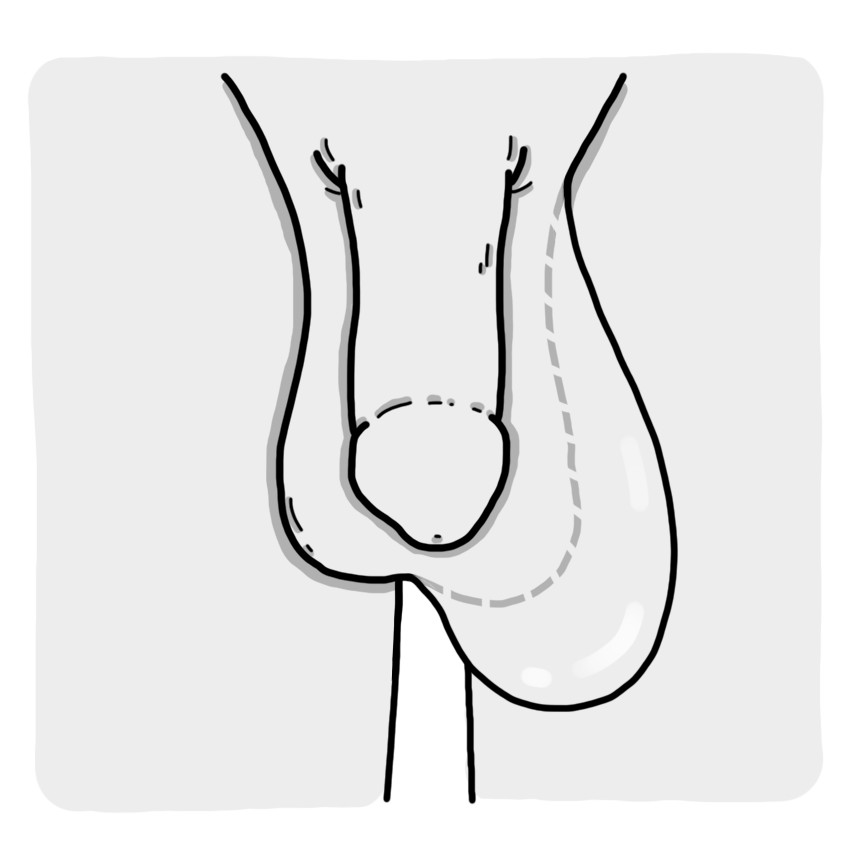 Increased testicle size