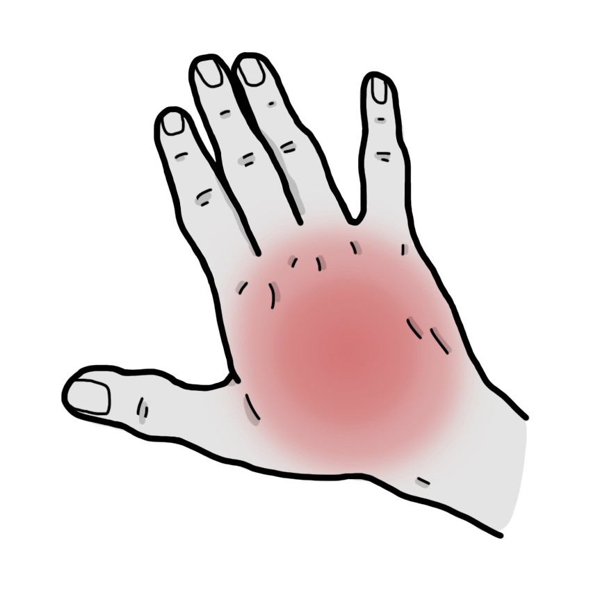 Πόνος στο χέρι