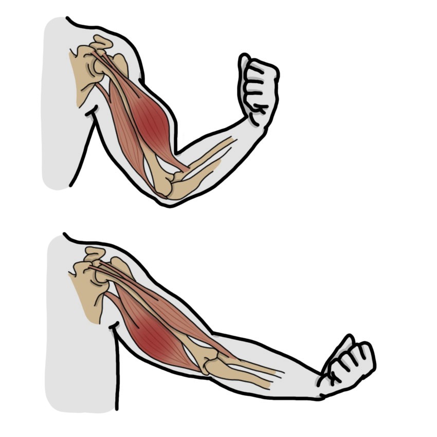 Contracción muscular dolorosa