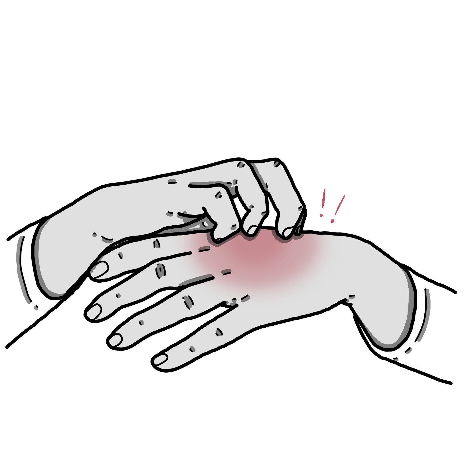 Démangeaisons dans la main