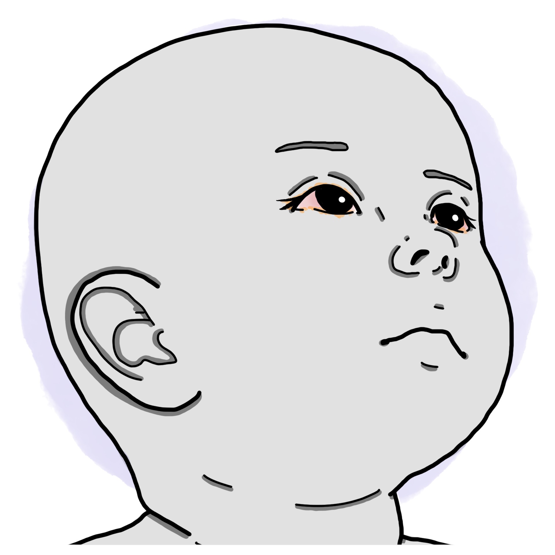 Bacterial conjunctivitis (Paediatrics)