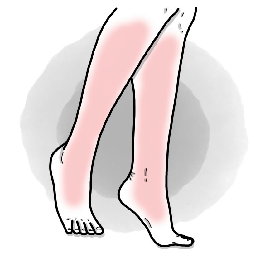 Benign acute myositis (Paediatrics)