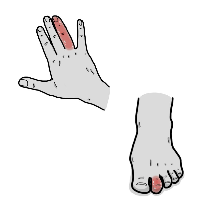 Dit inflat i enrogit