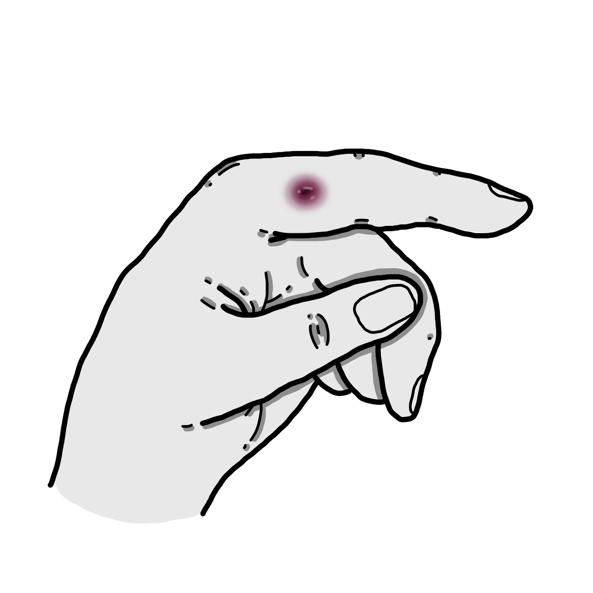 Osler's nodes