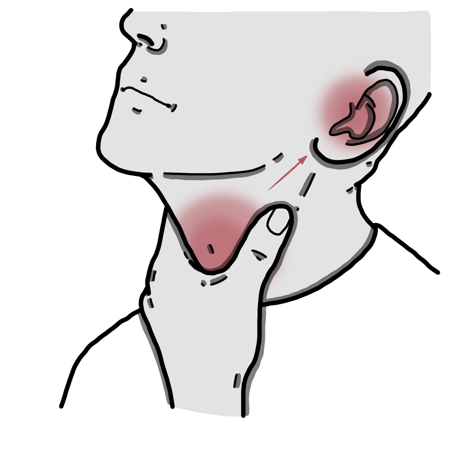 Mal de gorge qui va vers l’oreille