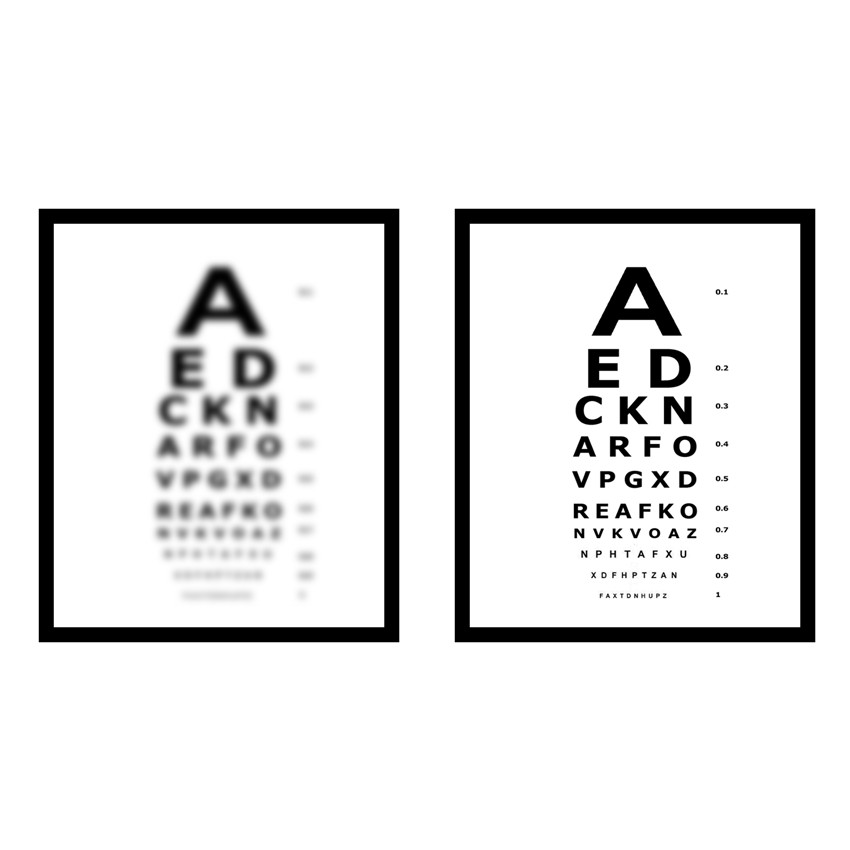 Partial loss of vision in only one eye