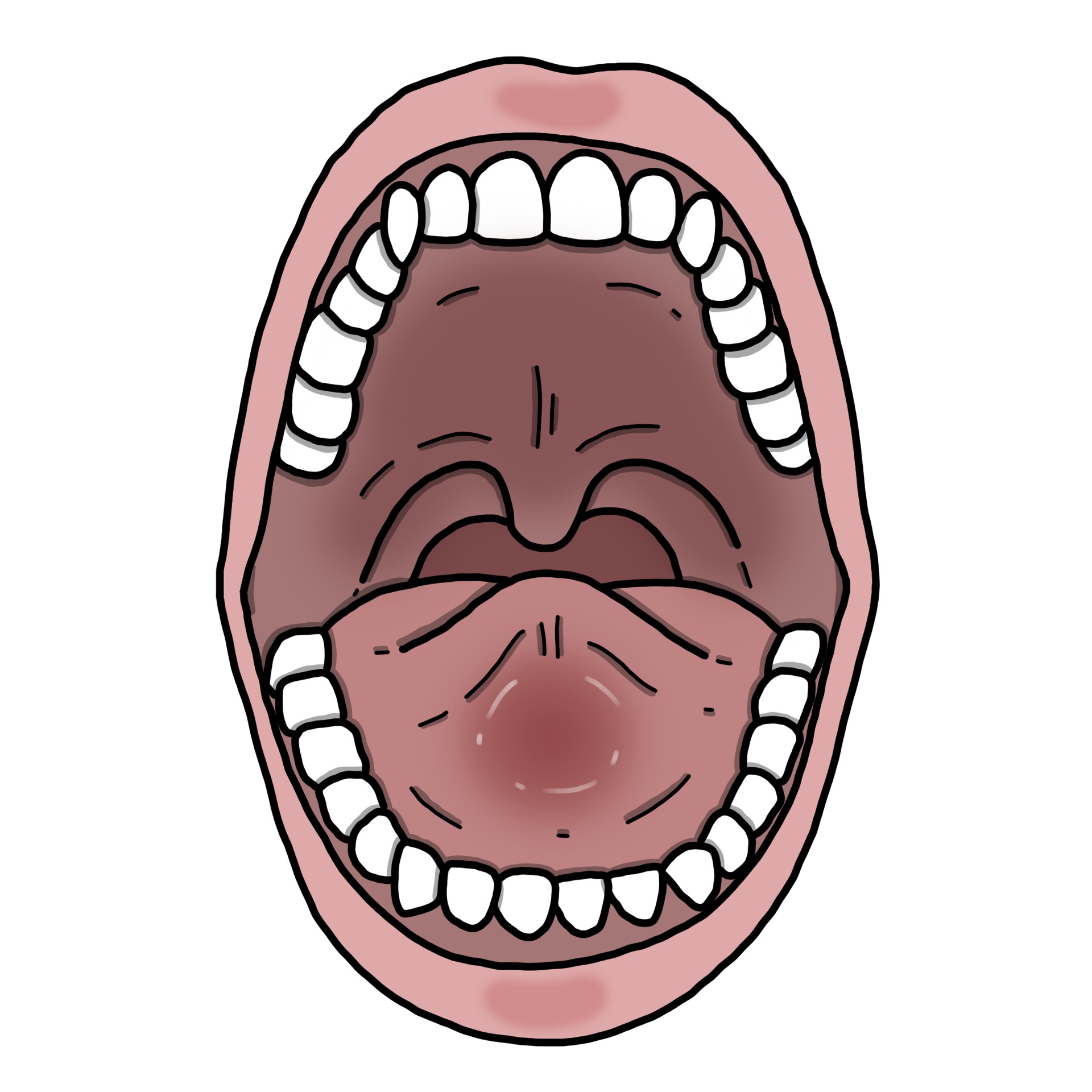 Der Mundboden ist geschwollen