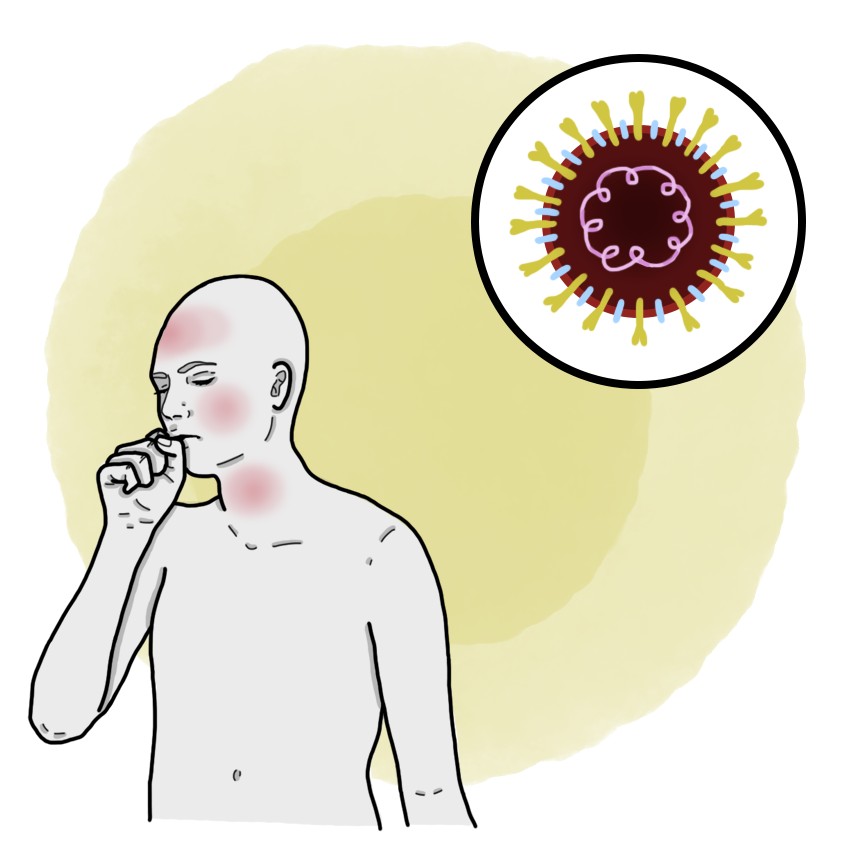 Coronavirus - COVID-19