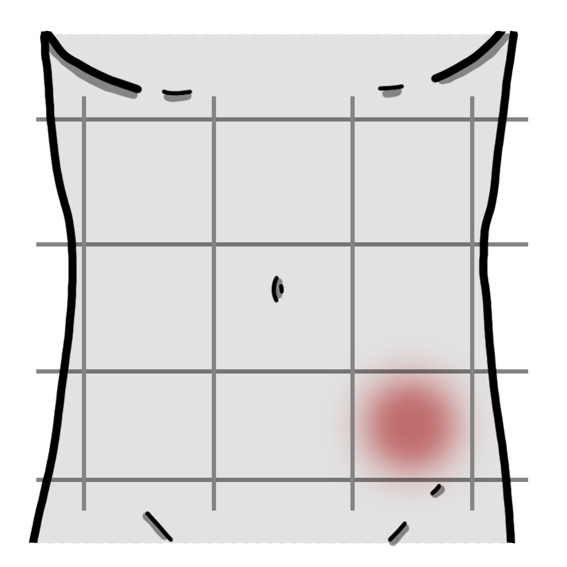 Douleur dans la partie inférieure gauche de l’abdomen