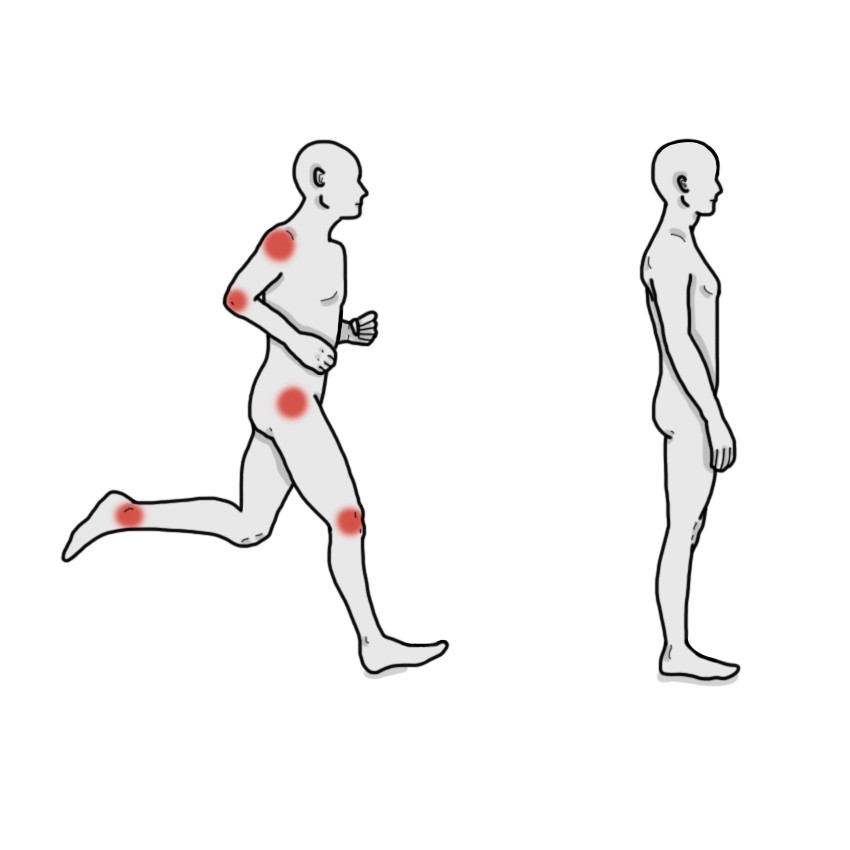Dolor augmenta en moviment i disminueix en repòs