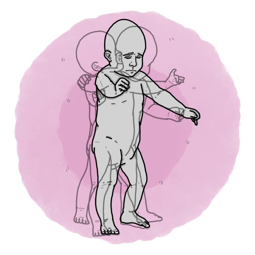 Ataxia (Paediatrics)