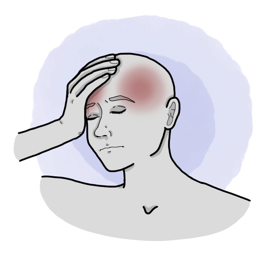 Common headache