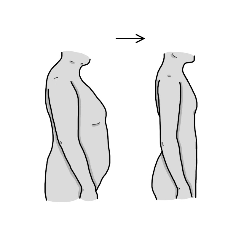 Perte de poids involontaire