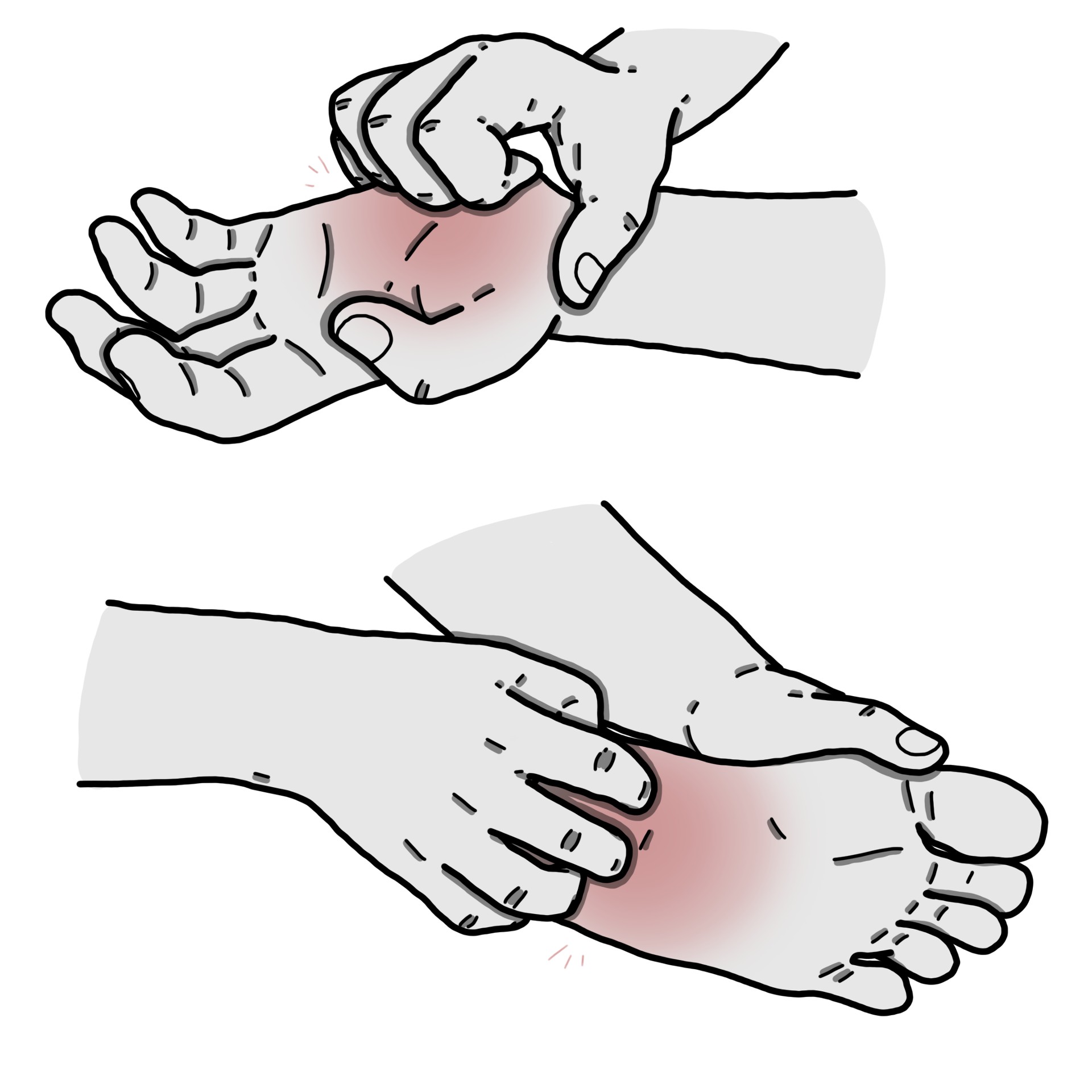 Itch on palms of hands and soles of the feet