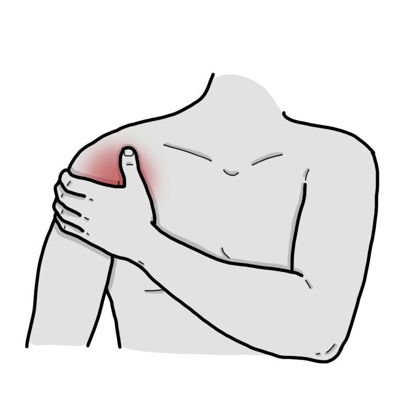 Dolor de hombro
