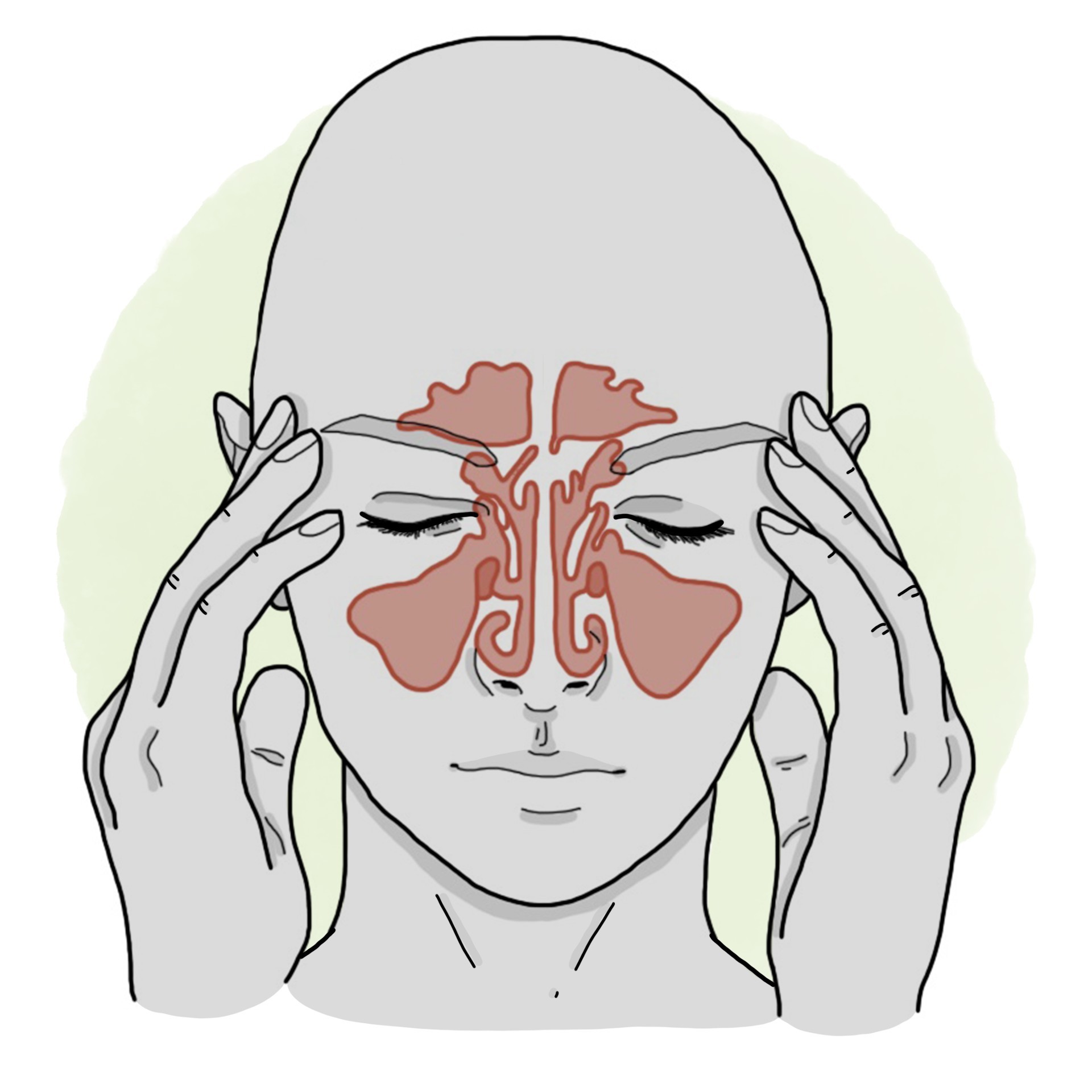 Sinusitis - Rhinosinusitis (Paediatrics)