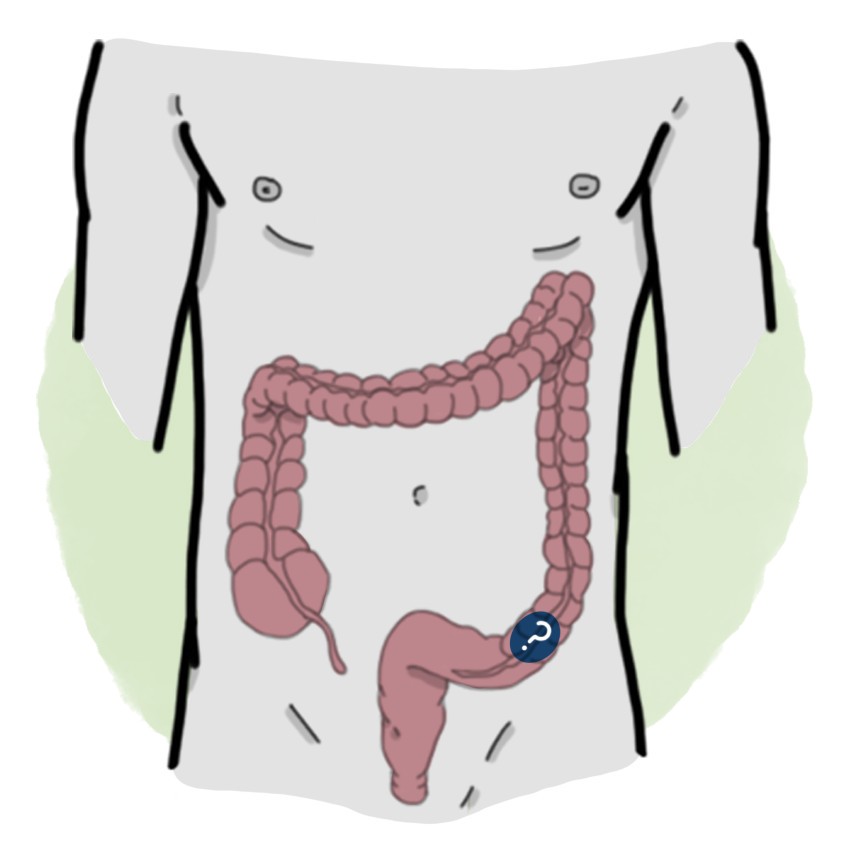 Colorectal foreign body