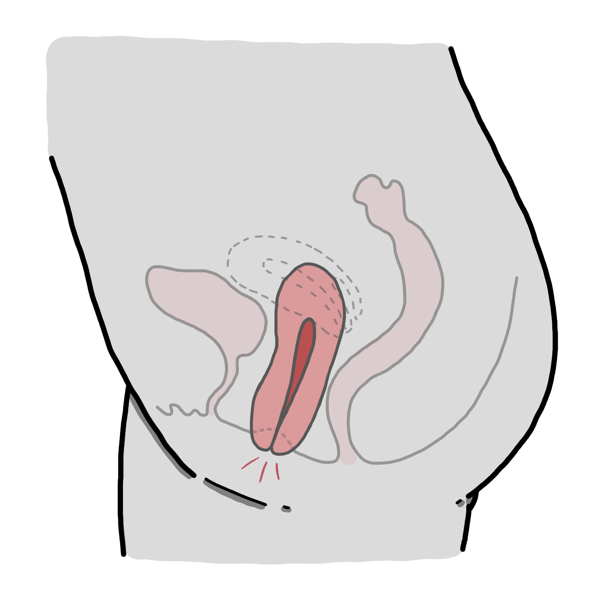 Caroço através da vulva