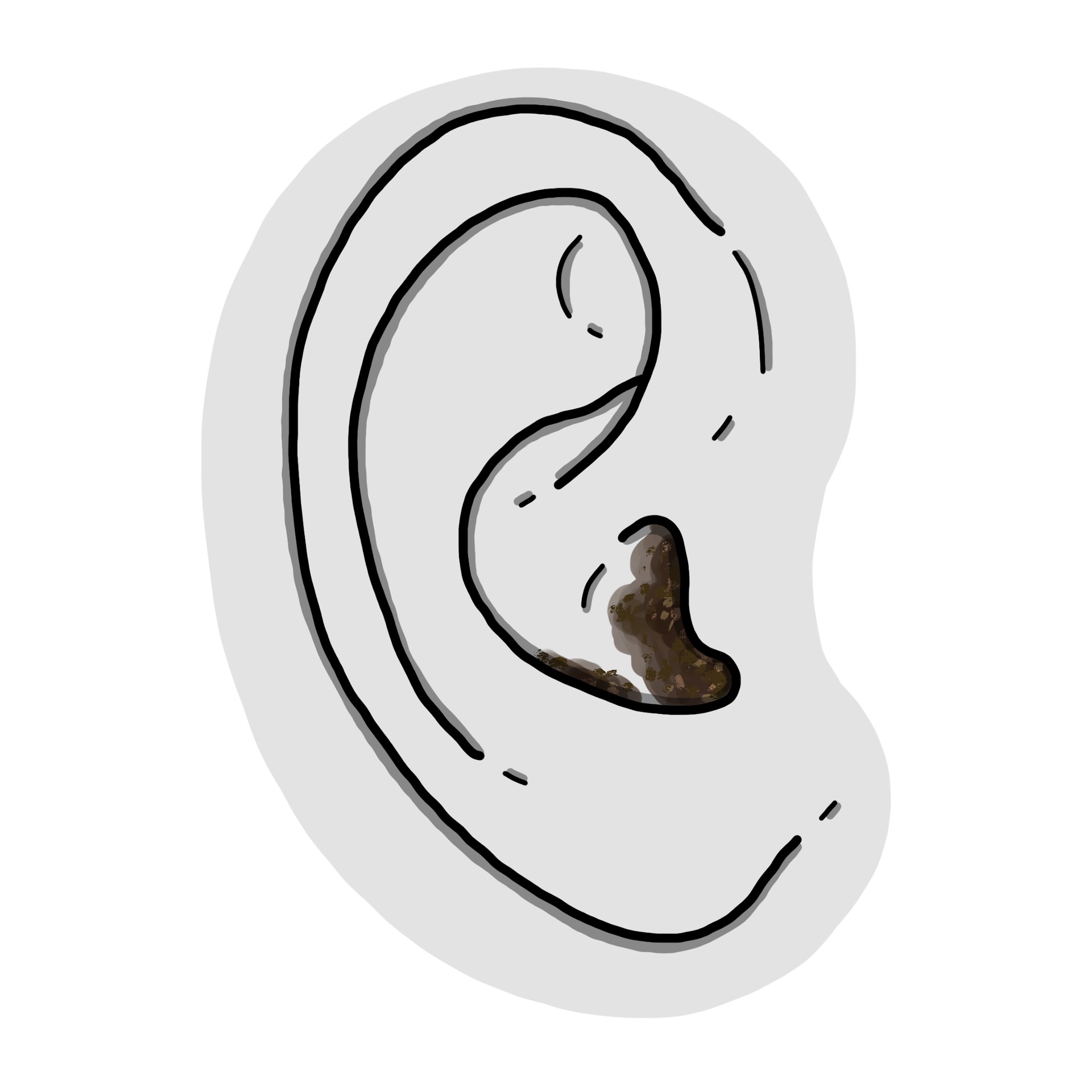 Cire noire dans l’oreille