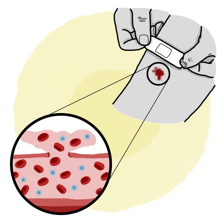 Congenital coagulopathy: Von Willebrand disease