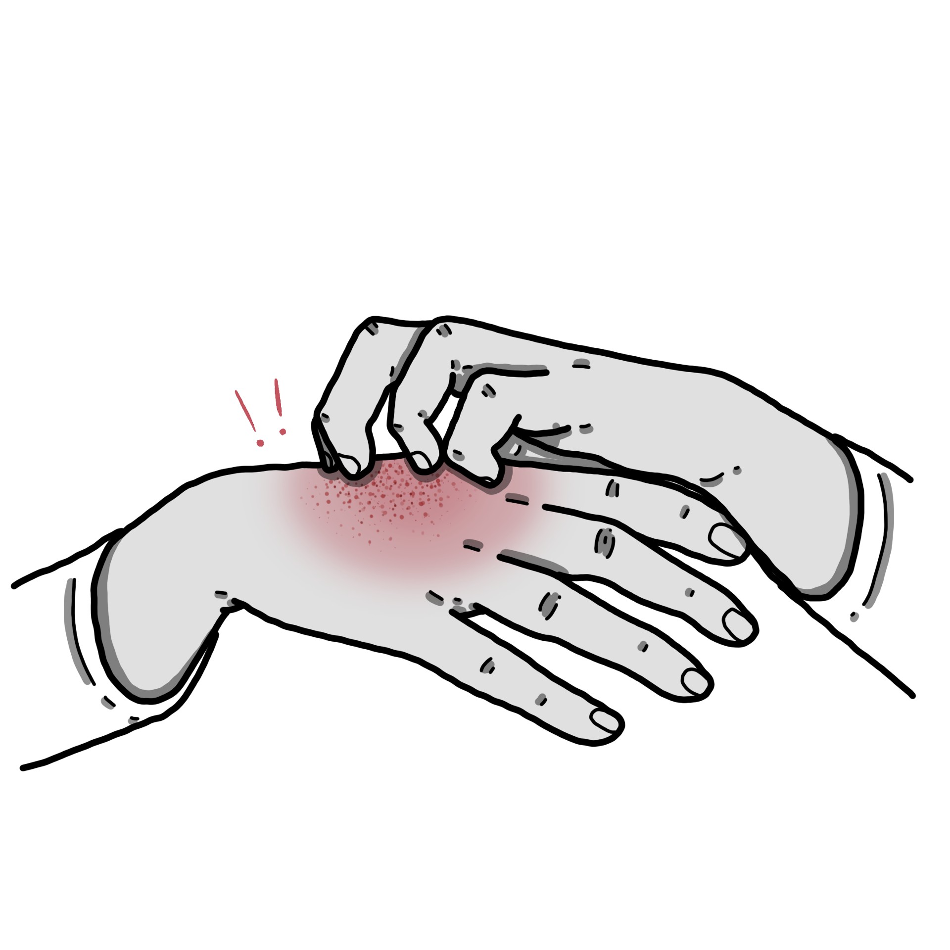 Herpetiform dermatitis