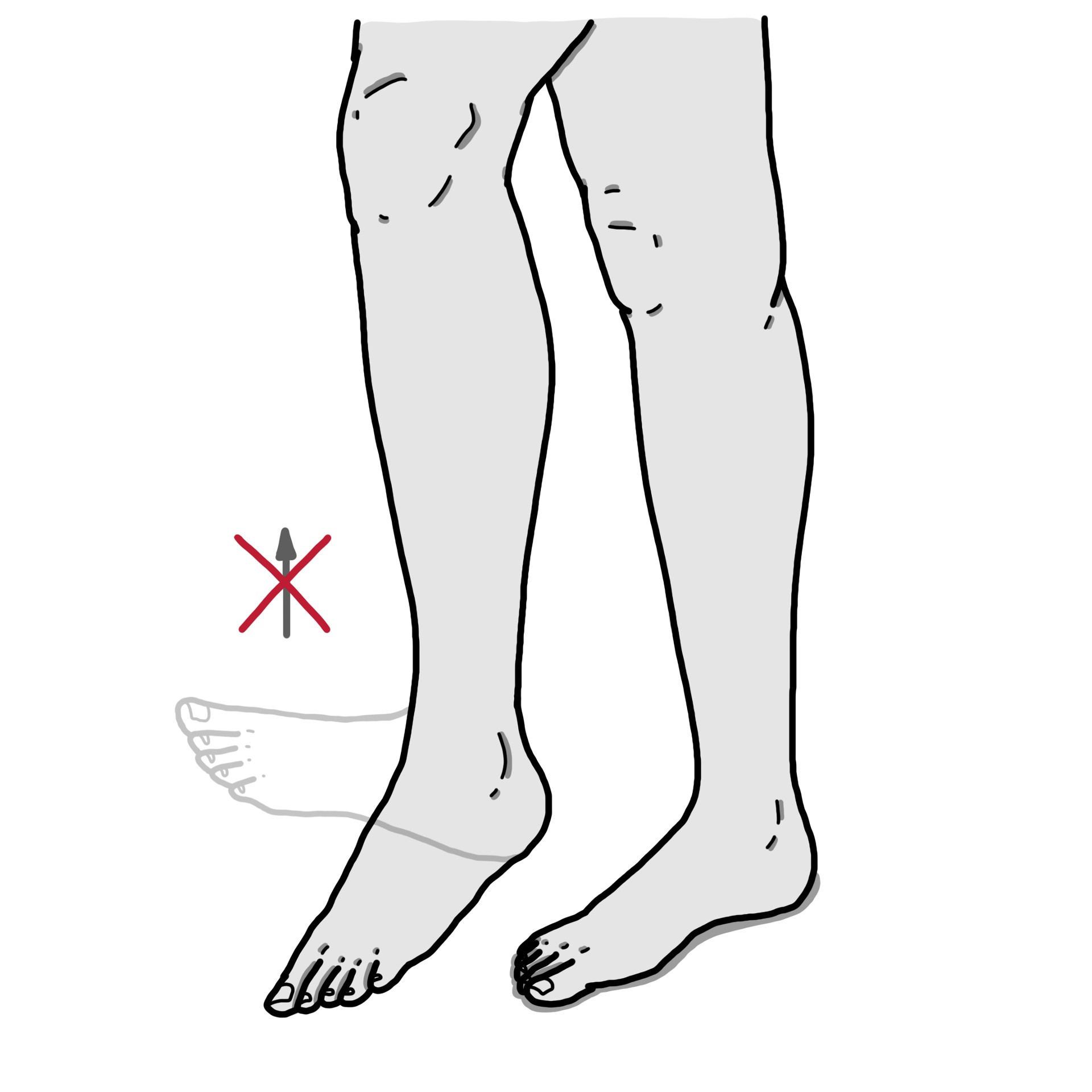 Weak foot dorsiflexion