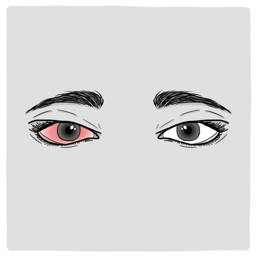 Un œil rouge
