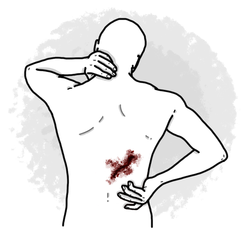 Back wound