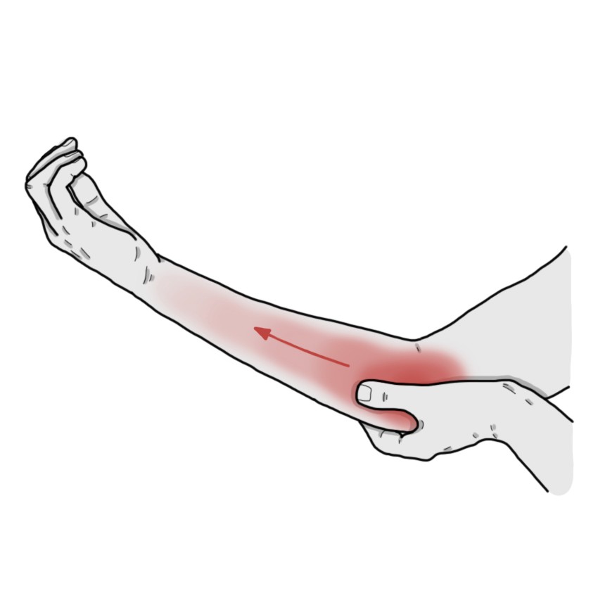 Inner side of the elbow pain to the forearm