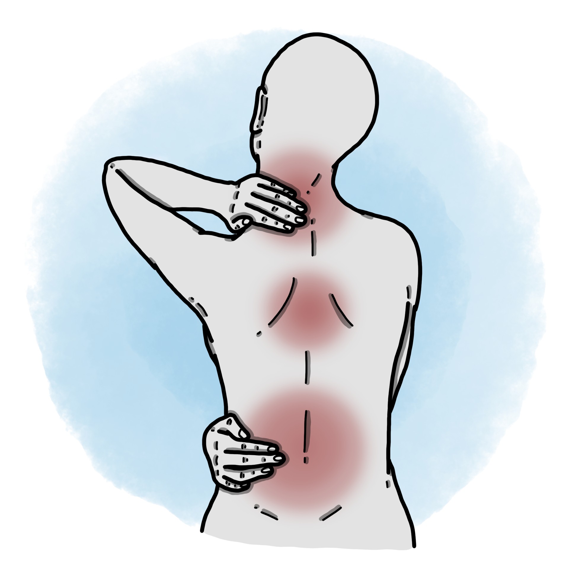Muscle back pain - Osteomuscular back pain