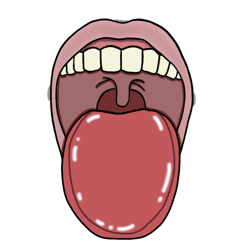 Lingua gonfia