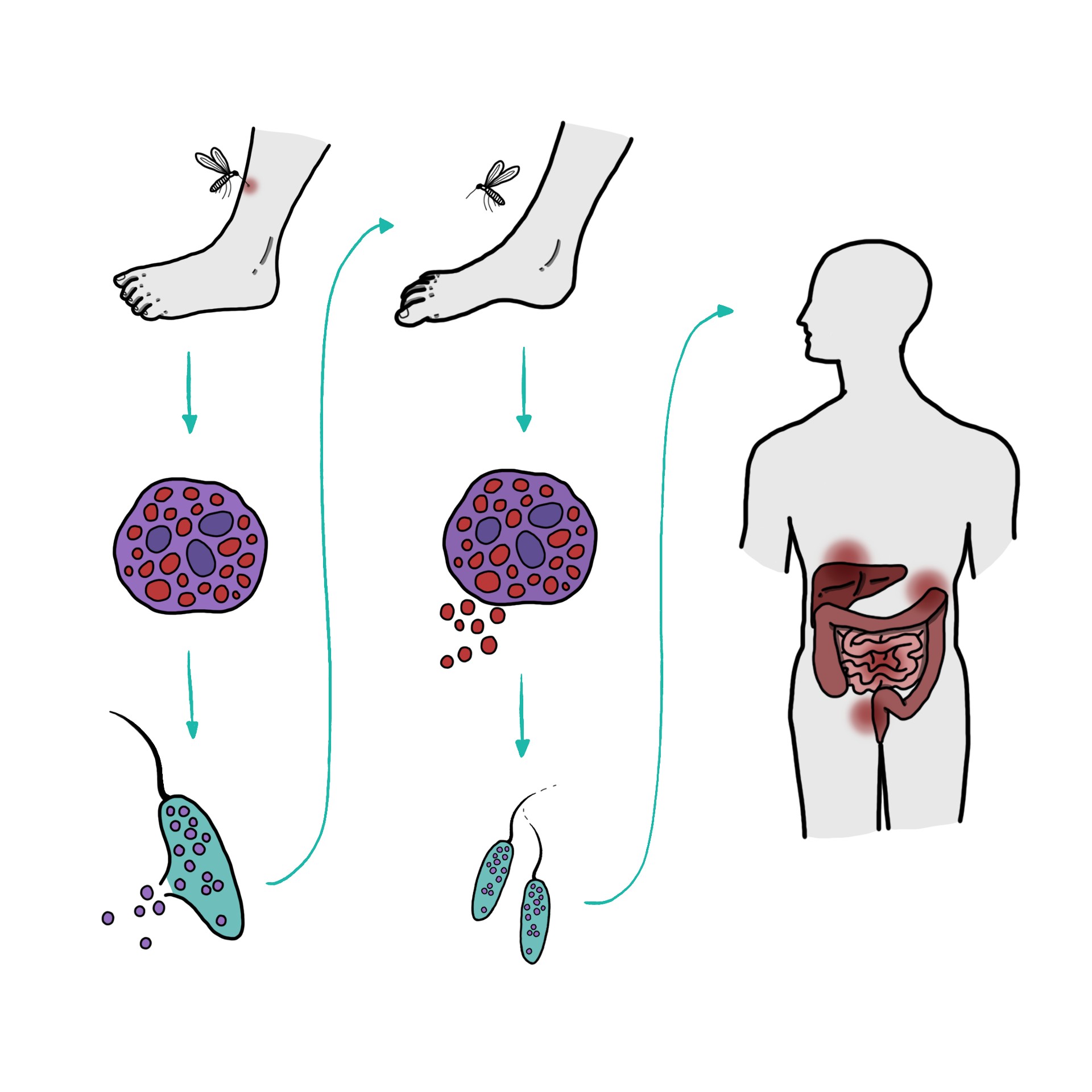 Mucosal leishmaniasis - Mucocutaneous leishmaniasis