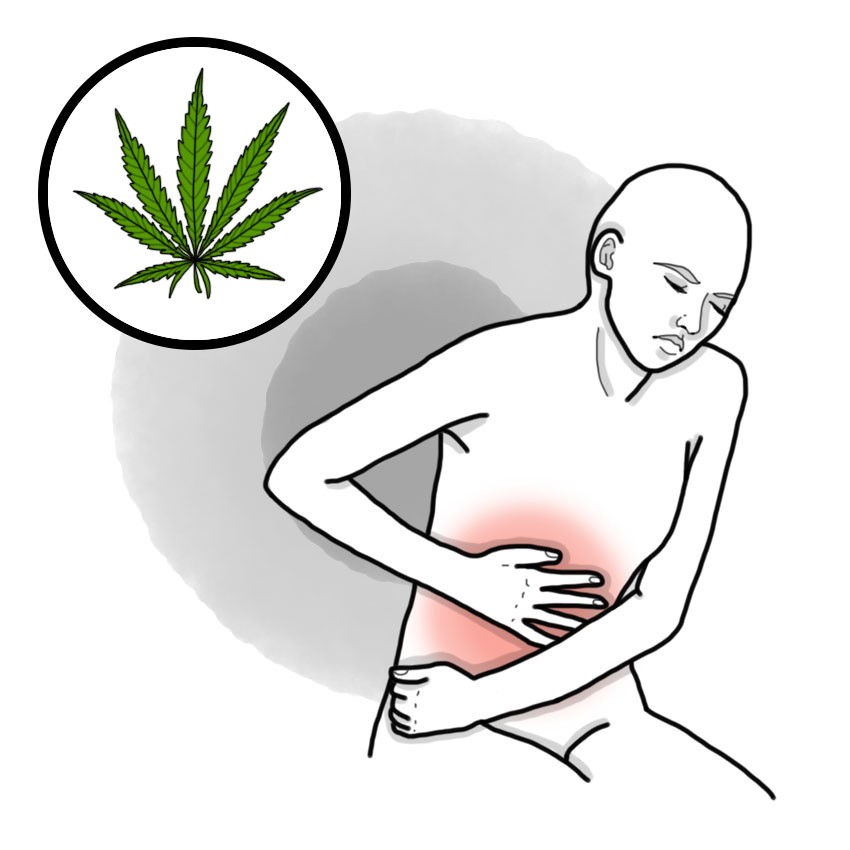 Marijuana poisoning - Cannabis