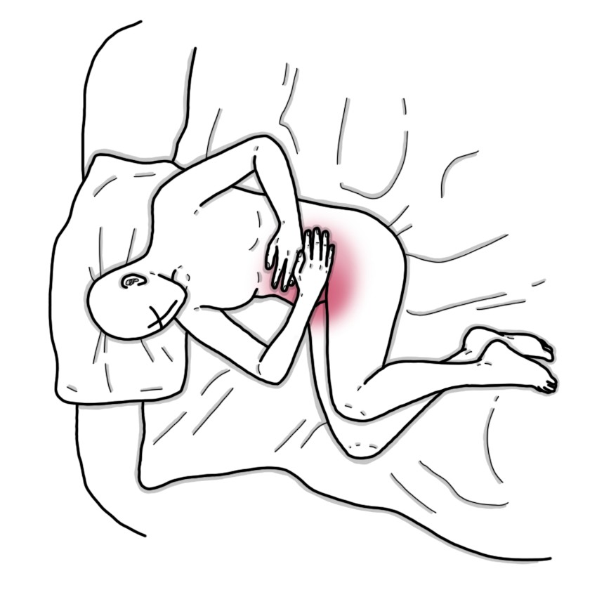 Premenstrual tension - Premenstrual syndrome